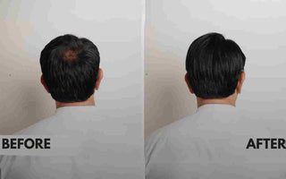 Hair Toppers for Men: A Solution to Hair Loss