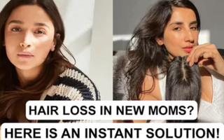 Hair loss in new moms? Here is an instant solution!